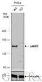Anti-JARID2 antibody used in Western Blot (WB). GTX129019