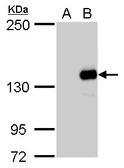 Anti-JARID2 antibody used in Western Blot (WB). GTX129020