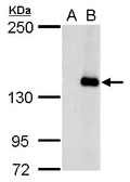 Anti-JARID2 antibody used in Western Blot (WB). GTX129021