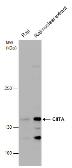 Anti-CIITA antibody used in Western Blot (WB). GTX129022