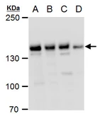 Anti-PHF2 antibody used in Western Blot (WB). GTX129028