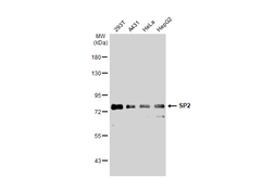 Anti-SP2 antibody used in Western Blot (WB). GTX129030