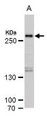 Anti-SETD1A antibody used in Western Blot (WB). GTX129035