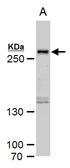 Anti-SETD1A antibody used in Western Blot (WB). GTX129035