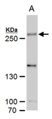 Anti-SETD1A antibody used in Western Blot (WB). GTX129036
