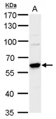 Anti-CARM1 antibody used in Western Blot (WB). GTX129040