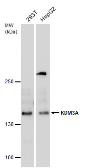 Anti-KDM3A antibody used in Western Blot (WB). GTX129046