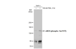 Anti-eNOS (phospho Ser1177) antibody used in Western Blot (WB). GTX129058