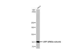 Anti-LRP1 (85kDa subunit) antibody used in Western Blot (WB). GTX129086