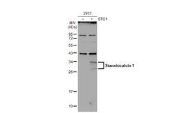 Anti-Stanniocalcin 1 antibody used in Western Blot (WB). GTX129092