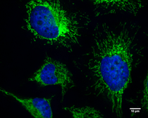 Anti-FIP200 antibody used in Immunocytochemistry/ Immunofluorescence (ICC/IF). GTX129093