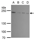 Anti-FIP200 antibody used in Western Blot (WB). GTX129094