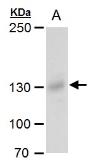 Anti-Rubicon antibody used in Western Blot (WB). GTX129096