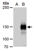 Anti-Rubicon antibody used in Western Blot (WB). GTX129096