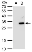 Anti-ATG10 antibody used in Western Blot (WB). GTX129097