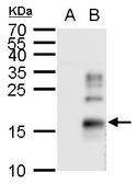 Anti-TGF alpha antibody used in Western Blot (WB). GTX129103