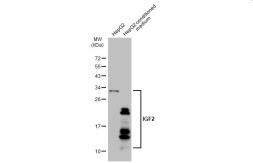 Anti-IGF2 antibody used in Western Blot (WB). GTX129110