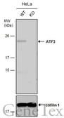 Anti-ATF3 antibody used in Western Blot (WB). GTX129120