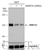 Anti-DNMT3A antibody used in Western Blot (WB). GTX129125