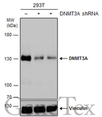 Anti-DNMT3A antibody used in Western Blot (WB). GTX129125