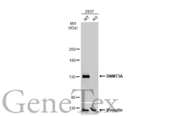 Anti-DNMT3A antibody used in Western Blot (WB). GTX129125