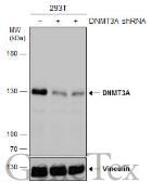 Anti-DNMT3A antibody used in Western Blot (WB). GTX129126
