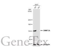 Anti-DNMT3A antibody used in Western Blot (WB). GTX129126
