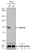Anti-DNMT3B antibody used in Western Blot (WB). GTX129127