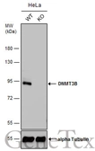 Anti-DNMT3B antibody used in Western Blot (WB). GTX129127