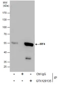 Anti-IRF4 / MUM1 antibody used in Immunoprecipitation (IP). GTX129135