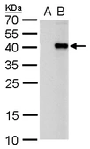 Anti-PITX2 antibody used in Western Blot (WB). GTX129141