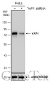 Anti-YAP1 antibody used in Western Blot (WB). GTX129151