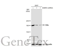 Anti-G9a antibody used in Western Blot (WB). GTX129153
