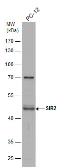 Anti-SIRT2 antibody used in Western Blot (WB). GTX129154