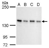Anti-SIN3A antibody used in Western Blot (WB). GTX129156