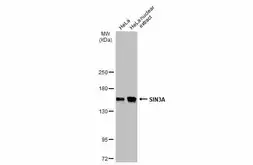 Anti-SIN3A antibody used in Western Blot (WB). GTX129156