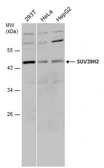 Anti-SUV39H2 antibody used in Western Blot (WB). GTX129167