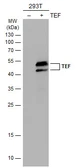 Anti-TEF antibody used in Western Blot (WB). GTX129182