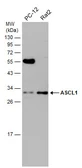 Anti-ASCL1 antibody used in Western Blot (WB). GTX129189