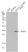 Anti-ASCL1 antibody used in Western Blot (WB). GTX129189