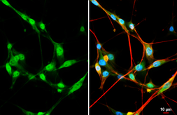 Anti-ER81 antibody used in Immunocytochemistry/ Immunofluorescence (ICC/IF). GTX129202