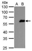 Anti-FOXJ1 antibody used in Western Blot (WB). GTX129205