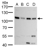 Anti-MCM6 antibody used in Western Blot (WB). GTX129217