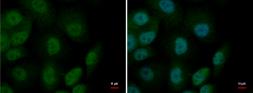 Anti-MTF1 antibody used in Immunocytochemistry/ Immunofluorescence (ICC/IF). GTX129220
