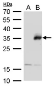 Anti-Neurogenin 1 antibody used in Western Blot (WB). GTX129224