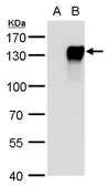 Anti-NFATC4 antibody used in Western Blot (WB). GTX129225