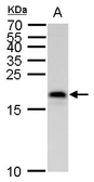 Anti-MAFK antibody used in Western Blot (WB). GTX129240