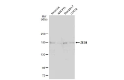 Anti-ZEB2 antibody used in Western Blot (WB). GTX129243