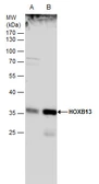 Anti-HOXB13 antibody used in Western Blot (WB). GTX129245