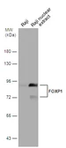 Anti-FOXP1 antibody used in Western Blot (WB). GTX129252